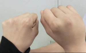骨折している様子