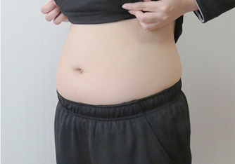 婦人病・産後の体型の悩み